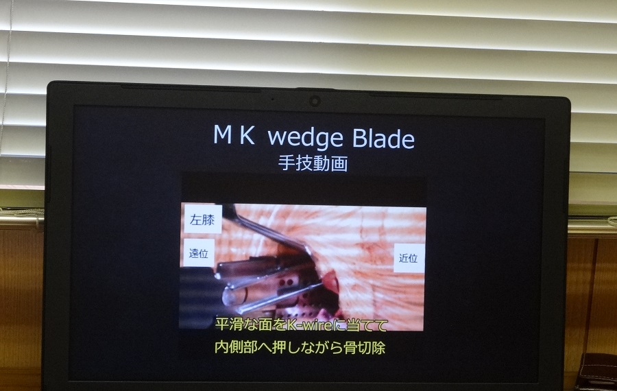 モニターに映る医療機器